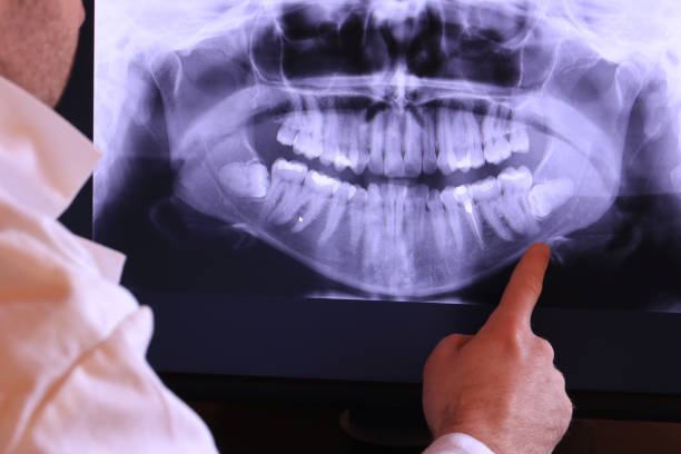 Best Emergency Dental Surgery in Fruitdale, CA