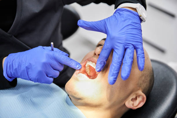 Best Emergency Root Canal Treatment in Fruitdale, CA