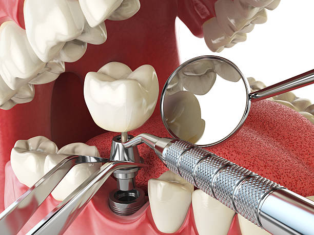 Best Emergency Broken Tooth Repair in Fruitdale, CA