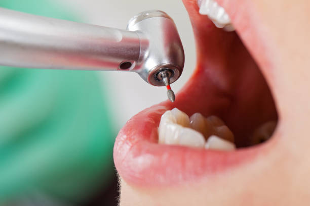 Best After-Hours Emergency Dentist in Fruitdale, CA